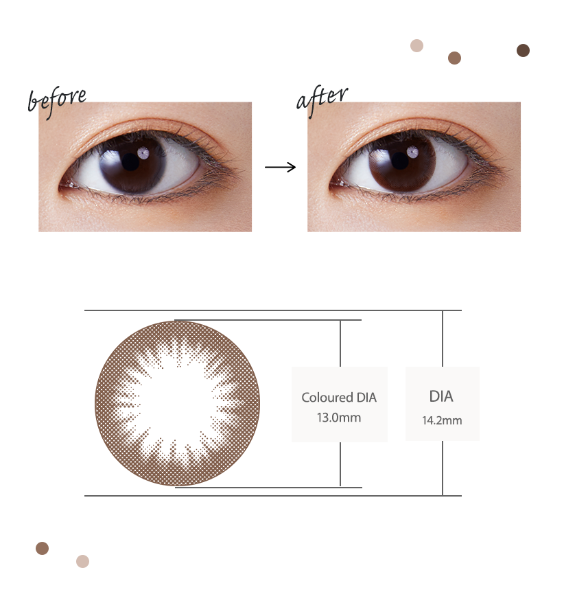 eye with a brown colou